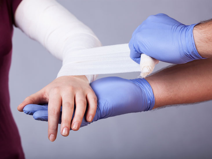 Medical Support For Your Hand